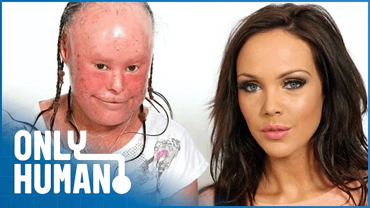 A Glamour Model & A Woman With Facial Disfigurements Meet: The Ugly Face of Prejudice | Only Human - DayDayNews