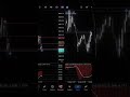 Complete Trading Breakdown | Every Trade I Took This Week