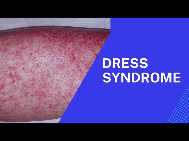 dress disease