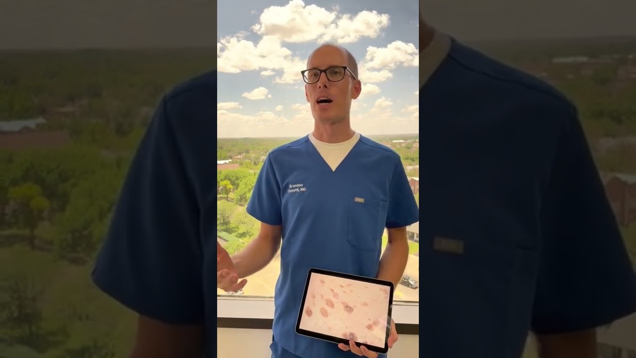 Q & A w/ Dr. B:  Age Spots Demystified!