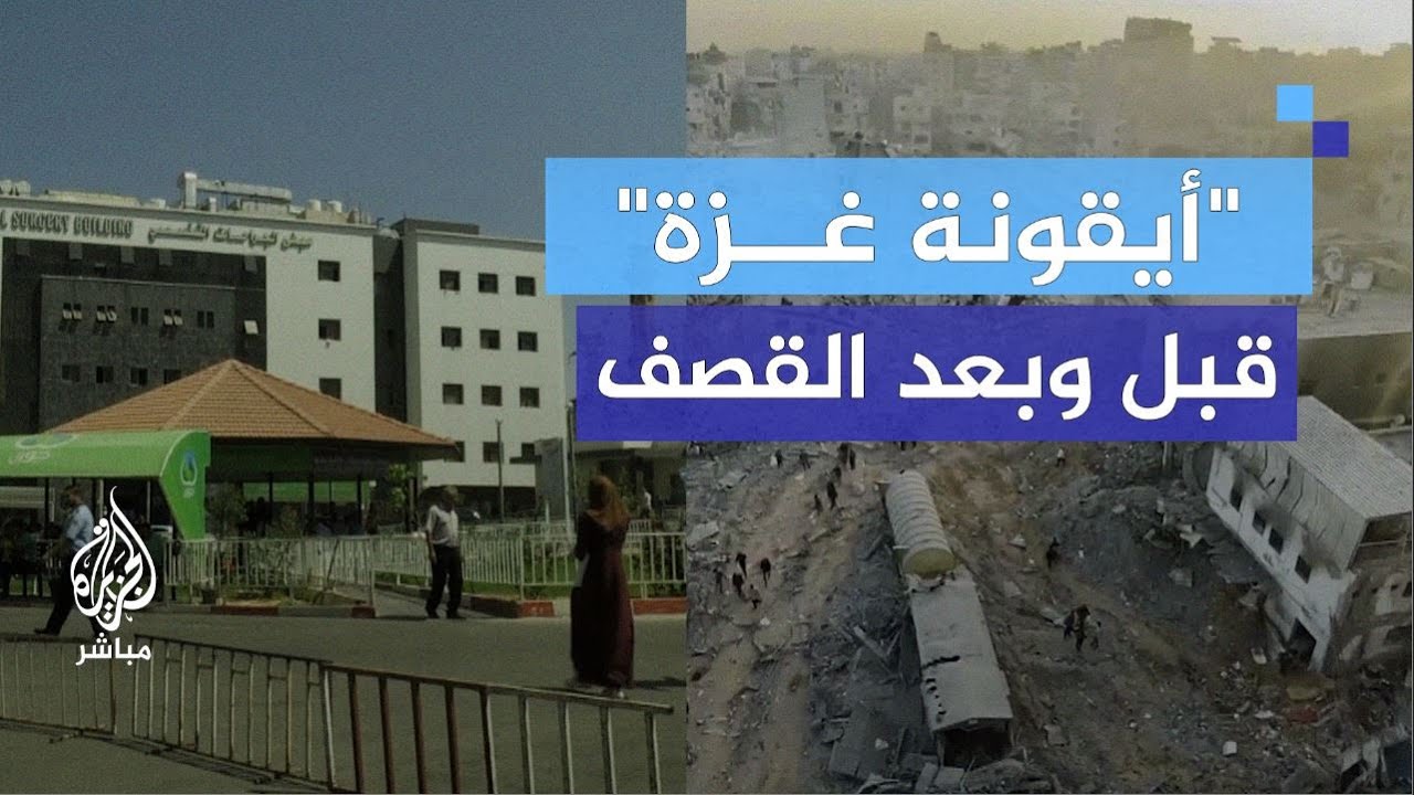 مجمّع الشفاء الطبي في غزة قبل وبعد العدوان الإسرائيلي