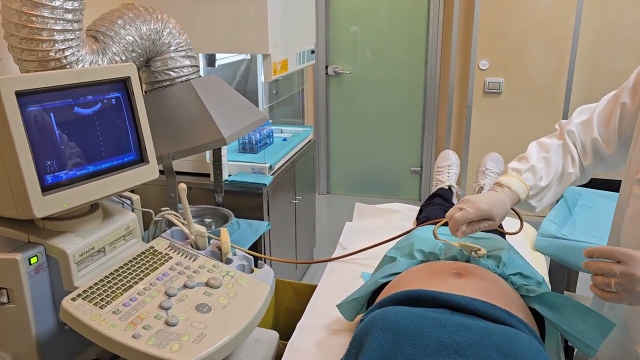 Come viene eseguita la villocentesi - Altamedica Artemisia Roma