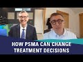 How PSMA Can Change Treatment  Decisions for Prostate Cancer | Mark Moyad, MD, MPH & Mark Scholz, MD