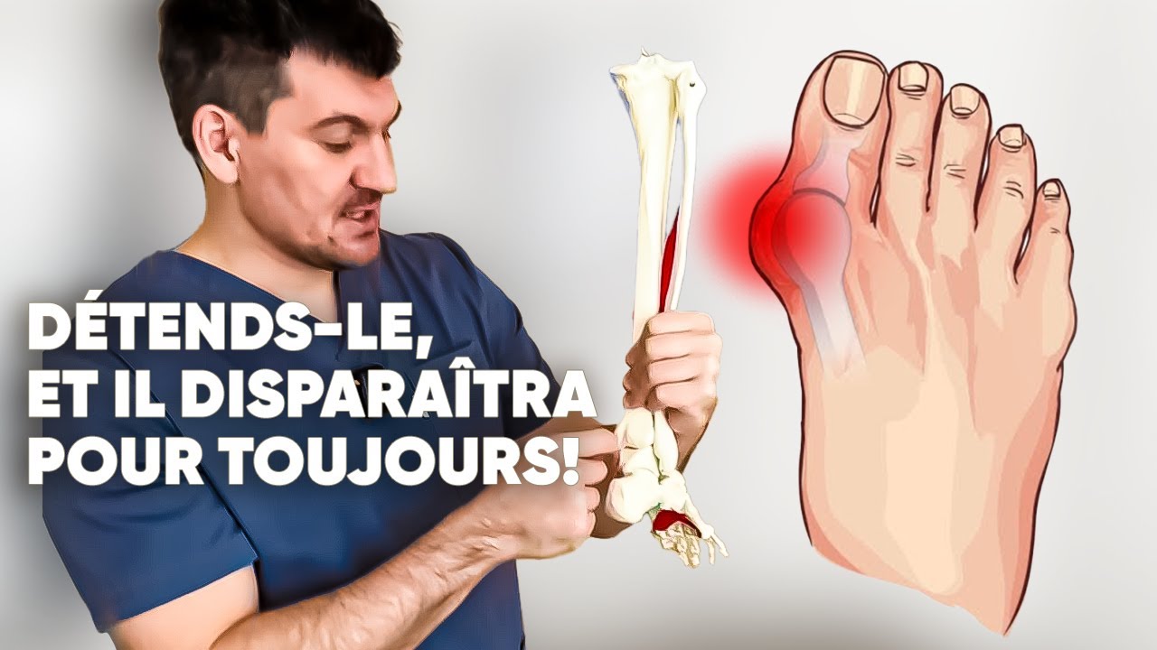 Détends ce muscle et ton oignon disparaîtra pour de bon ! Essaie-le!