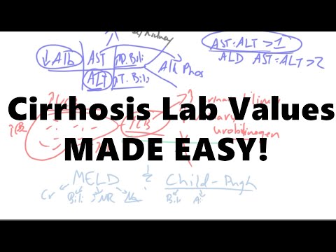 Cirrhosis Lab values MADE EASY!