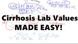 Cirrhosis Lab values MADE EASY! by Med Messy Notes  1,761 views 5 years ago 13 minutes, 55 seconds