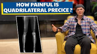 HOW PAINFUL IS QUADRILATERAL PRECICE LENGTHENING?