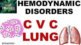 Chronic Venous Congestion - LUNG: Pathogenesis, Gross & Microscopy