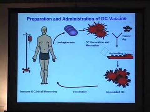 Using Dendritic Cells to Create Cancer Vaccines