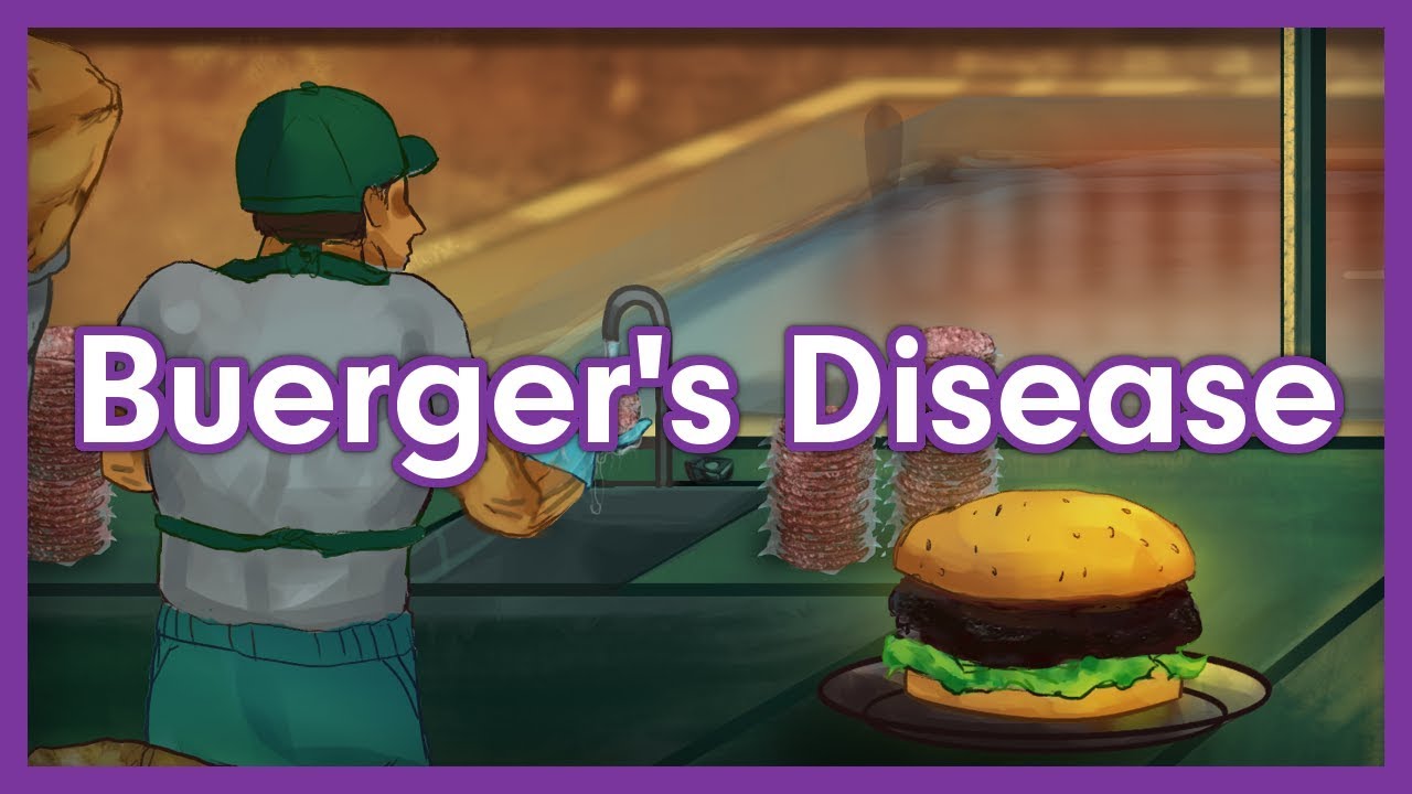 Buerger's Disease (Thromboangiitis Obliterans) Vasculitis Mnemonic