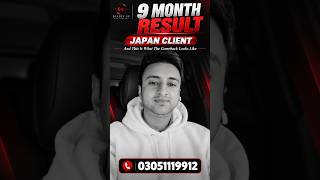 9 Month Hair Transplant Result | Client Travelled From Japan to Lahore | Beauty Up Aesthetics