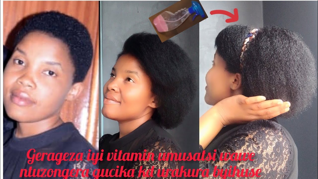 Iyi vitamin yamfashije gukuza umusatsi vuba,iwurinda gucika urabyibuha bigaragara nawe yigerageze 