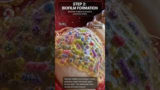 Why Does Plaque Remain Even After Brushing?" 🦷🦠 #science #microbiology #shortvideo #oralmicrobiome