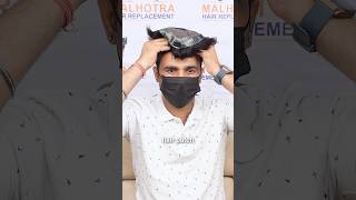 Hair Patch Clip System | Hair Patch Clipping Method | Clip System Hair Patch for Men