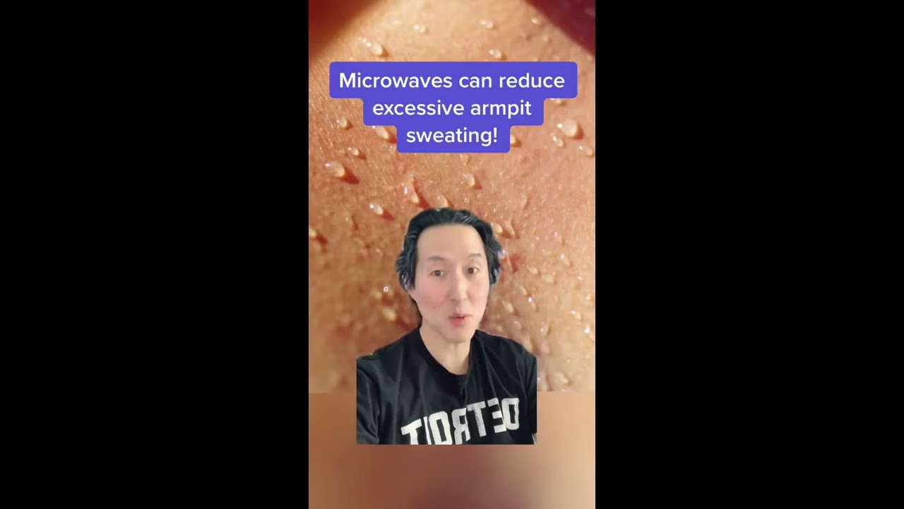 Excessive Armpit Sweating Hyperhidrosis Try MiraDry Shorts