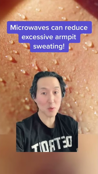 Excessive Armpit Sweating (Hyperhidrosis)? Try miraDry! #shorts