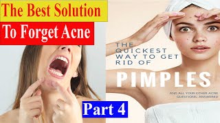 How can one get rid of acne as quickly as possible?-Blackheads Extraction ,Whiteheads Removal