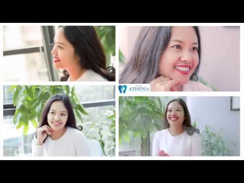 khách sạn athena quận 10 Update Bọc răng sứ - KH Nguyễn Thị Ngọc Minh( Lâm Đồng) - Athena