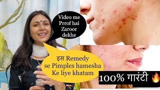 How To Remove Pimple And Acne | Face Se Pimple Kaise Hataye | Pimple Home Remedy | Dr. Upasana Vohra screenshot 2
