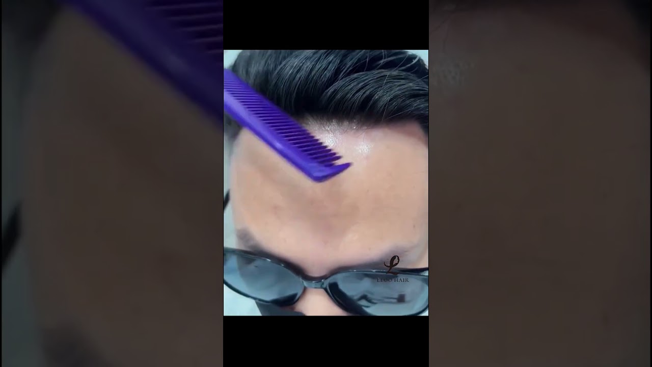 Do you like frontal lace hair system?