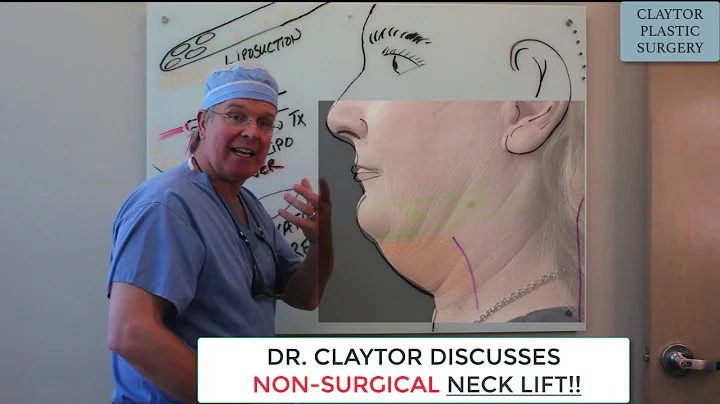 Necklift WITHOUT Surgery? MyEllevate, SmartLipo, L...