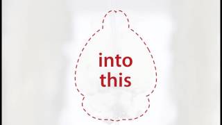 Time lapse mouse brain clearing using the X CLARITY™ Tissue Clearing System from Logos Biosystems