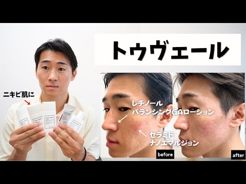 [Oily & Acne-Prone Skin] T'sVail Skincare Is Perfection… A Thorough Comparison from Retinol to Ba...