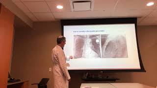 Part 1 HIS Bundle Pacing