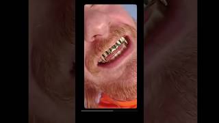 Gold Fangs