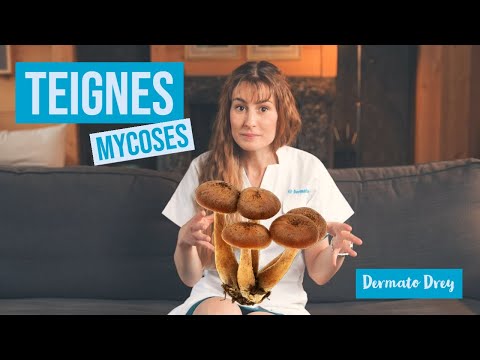Vidéo: Qu'est-ce qu'une teigne du cyprès ?
