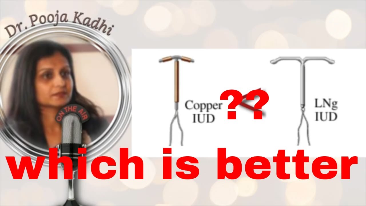 Hormonal IUD LNG IUS/MIRENA, which is better Copper T vs hormonal IUD