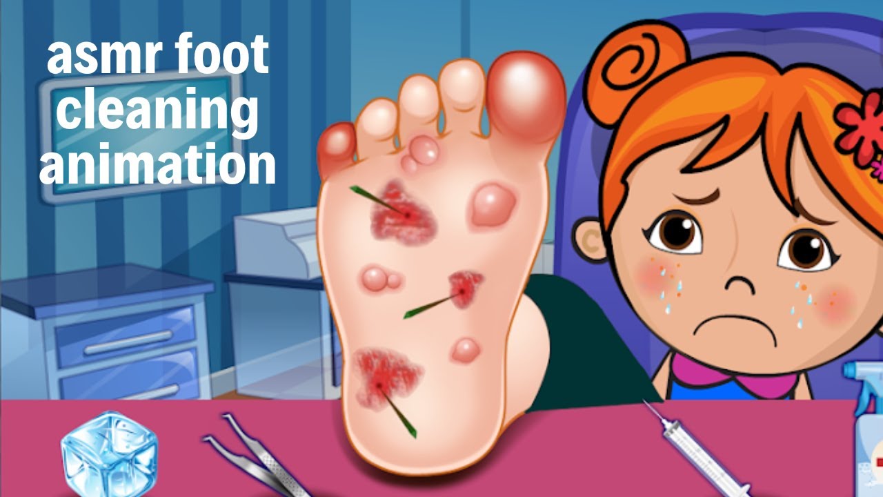 ASMR Surgery to Remove Large Plantar Warts Animation ASMR foot