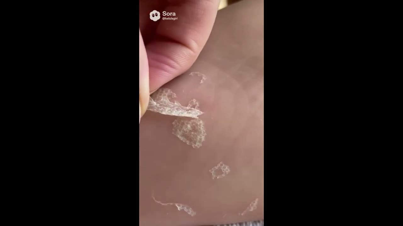 ASMR — Satisfying Foot Skin Peeling (Exfoliation & Texture Sounds)