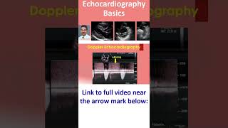 Echocardiography Basics