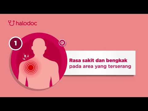 5 Gejala Leiomyosarcoma, Kanker pada Otot Polos