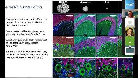 Advancing Therapeutics against Truly Novel Targets for CNS Diseases: From Human Tissue to the Clinic
