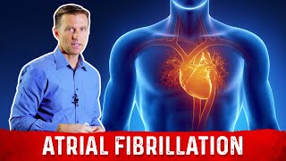 The Best Atrial Fibrillation Guidelines – Dr. Berg