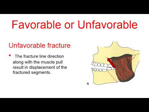 Video: Fracture Of The Upper And Lower Jaw - Consequences, Treatment And Nutrition