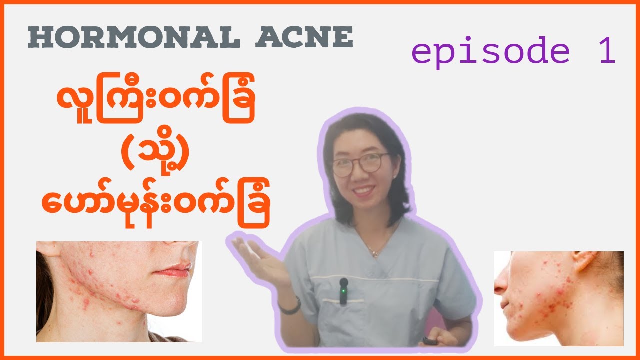 ဟော်မုန်းကြောင့်ဖြစ်လာတဲ့ဝက်ခြံ (အပိုင်း ၁)