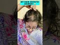 Female Hairloss Tretment