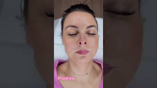 Creating Stunning Beautiful Lips - Lip Cosmetic Tattoo Perth - Nova You Beauty Perth