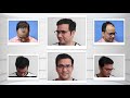 Best hair transplant clinic in india eugenix hair sciences