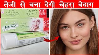 Zero Scar Cream | Eliminates Pimples, Acne, and Stretch Marks | Hindi