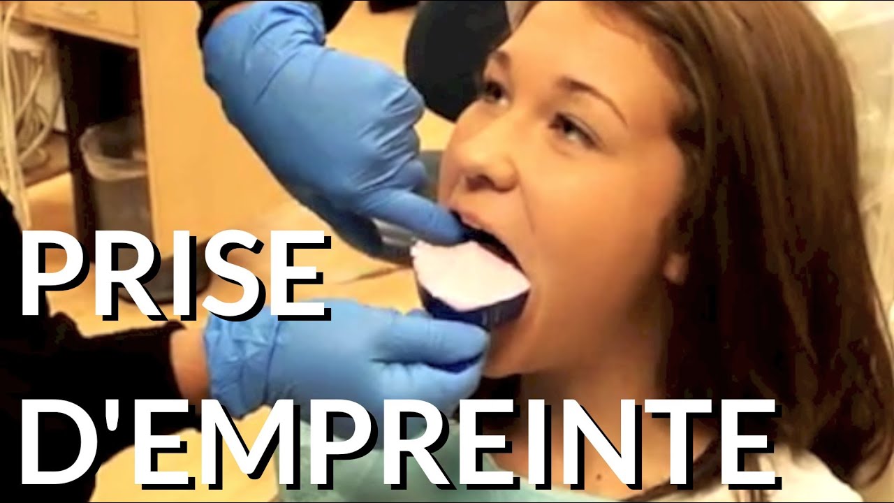 comment prendre empreinte dentaire