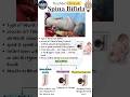 Spina Bifida| Neural Tube Defect | Pediatrics | Final year MBBS| YourMed Tutor #pediatrics #mbbs