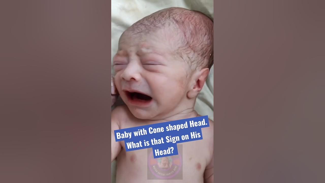 Adorable Newborn Baby with Cone shaped Head. YouTube