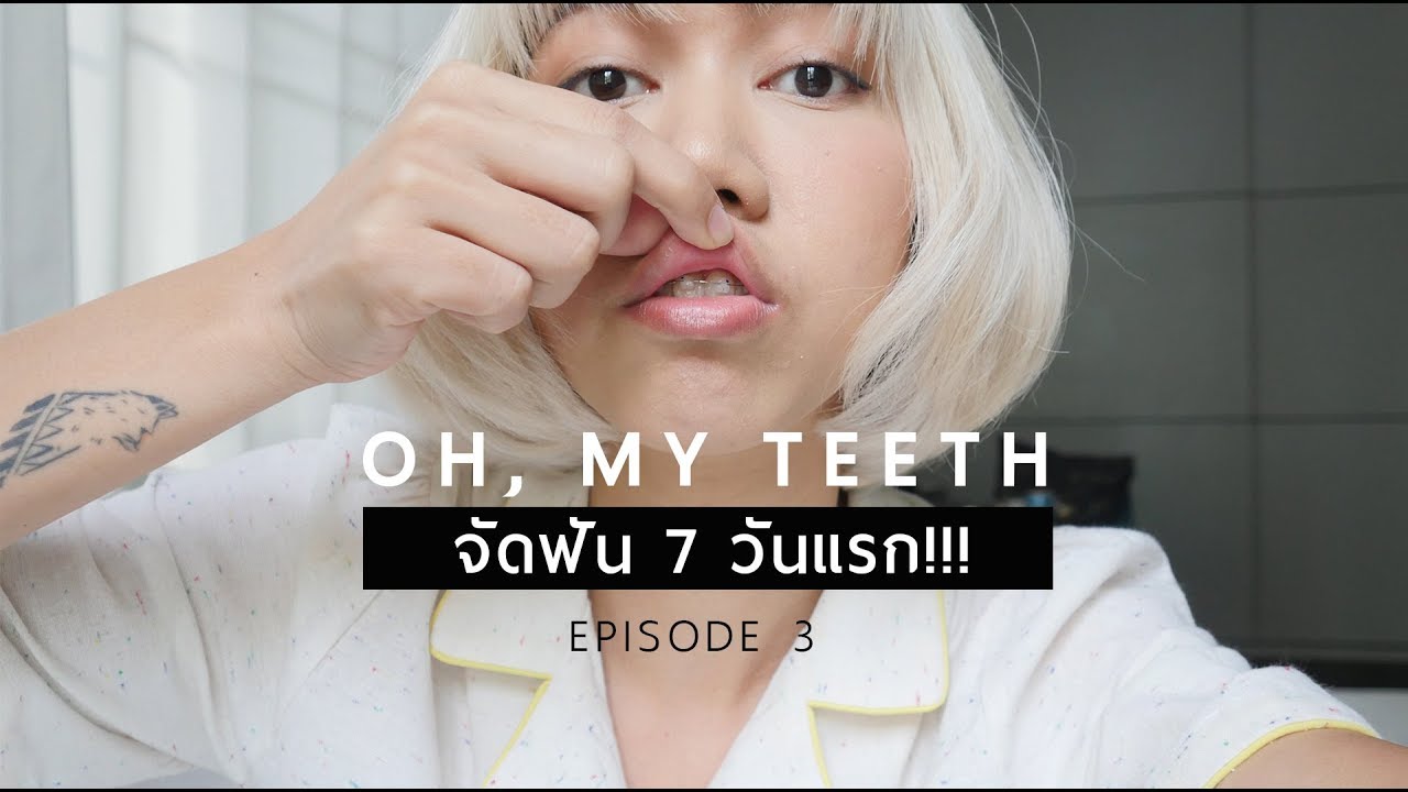 Oh! my teeth :: EP.3 จัดฟัน 7 วันแรก!!! ชีวิตไม่เหมือนเดิมอีกต่อไป . Ploy Sapphires