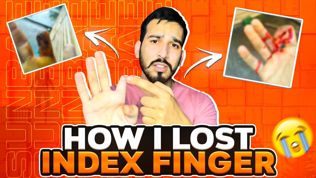 How i Lost My Index Finger @sunbaereal