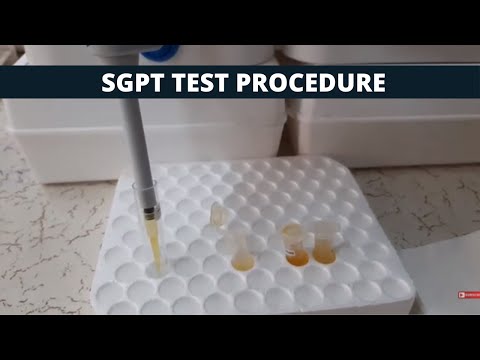 Video: ALT (Alanine Aminotransferase) Test: Doel, Procedure En Resultaten