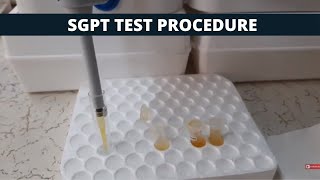 SGPT Test Procedure | SGPT Simple Test Procedure